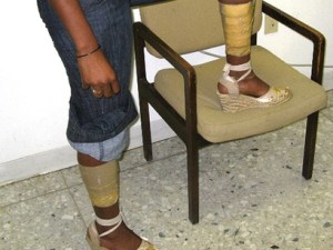 legwarmers legwarmers